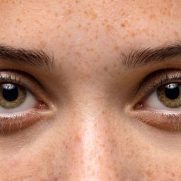 Blefaroplastia en Bogotá: armonía, función y bienestar para tu mirada