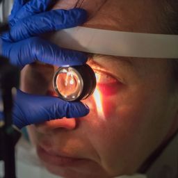 Control preventivo del Glaucoma para proteger tu visión