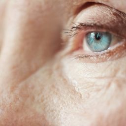Glaucoma en Bogotá: una enfermedad silenciosa que puede afectar tu visión