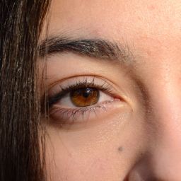 Oculoplastia en Bogotá: salud, funcionalidad y cuidado estético de la región ocular
