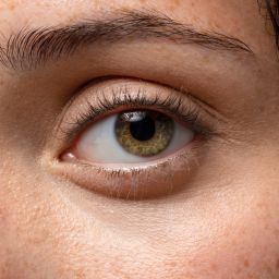 Retinopatía diabética en Bogotá: prevención y diagnóstico en el Día Mundial de la Diabetes 2025
